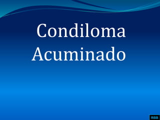 Condiloma
Acuminado
RBB
 