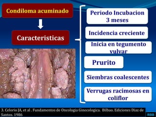 RBB
Condiloma acuminado
Caracteristicas
Periodo Incubacion
3 meses
Incidencia creciente
3. Celorio JA, et al . Fundamentos de Oncologia Ginecologica. Bilbao. Ediciones Diaz de
Santos. 1986
Inicia en tegumento
vulvar
Prurito
Siembras coalescentes
Verrugas racimosas en
coliflor
 