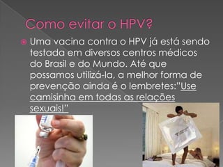    Uma vacina contra o HPV já está sendo
    testada em diversos centros médicos
    do Brasil e do Mundo. Até que
    possamos utilizá-la, a melhor forma de
    prevenção ainda é o lembretes:”Use
    camisinha em todas as relações
    sexuais!”
 