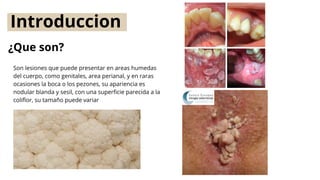 CONDILOMAS vph que son y como se tratan | PDF