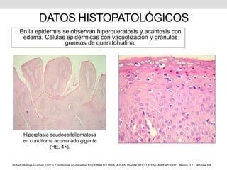 DATOS HISTOPATOLÓGICOS
• En la epidermis se observan hiperqueratosis y acantosis con
edema. Células epidérmicas con vacuolización y gránulos
gruesos de queratohialina.
Hiperplasia seudoepiteliomatosa
en condiloma acuminado gigante
(HE, 4×).
Roberto Arenas Guzman. (2013). Condilomas acuminados. En DERMATOLOGÍA, ATLAS, DIAGNÓSTICO Y TRATAMIENTO(937). Mexico D.F.: McGraw Hill.
 