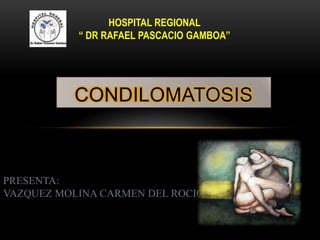 HOSPITAL REGIONAL
“ DR RAFAEL PASCACIO GAMBOA”

CONDILOMATOSIS

PRESENTA:
VAZQUEZ MOLINA CARMEN DEL ROCIO

 