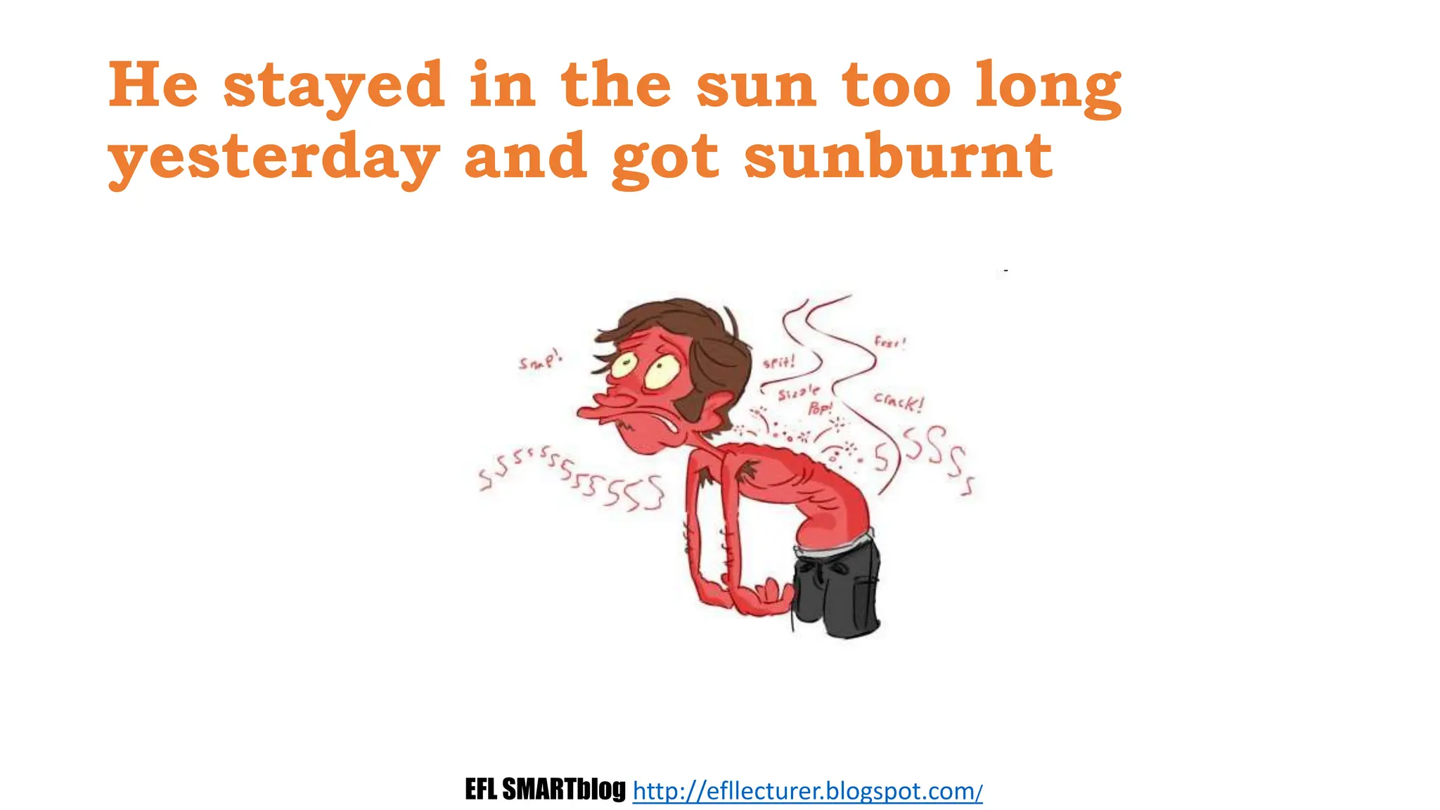 He stayed in the sun too long
yesterday and got sunburnt
EFL SMARTblog http://efllecturer.blogspot.com/
 