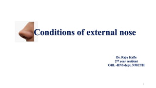 Conditions of external nose
Dr. Raju Kafle
2nd year resident
ORL -HNS dept, NMCTH
1
 