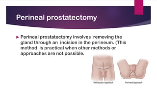 Cancer of Prostate
 Abnormal proliferation of cells of prostate.
 Most common carcinoma in men over 65 years.
 Etiology...