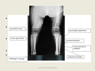 Conditions with abnormal collagen | PPTX
