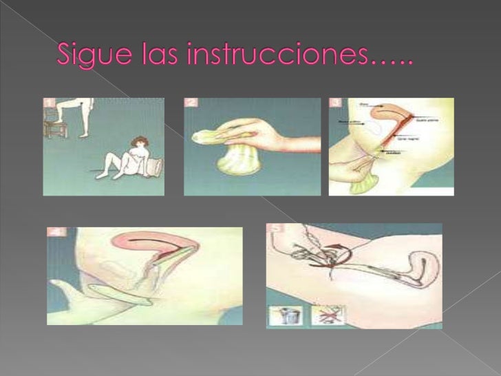 Que tal los pequeños granos rojos sobre el miembro viril