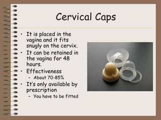 Cervical Caps
• It is placed in the
  vagina and it fits
  snugly on the cervix.
• It can be retained in
  the vagina for 48
  hours.
• Effectiveness
   – About 70-85%
• It’s only available by
  prescription
   – You have to be fitted
 