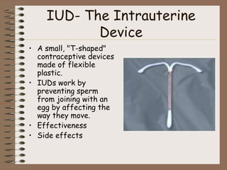 IUD- The Intrauterine
           Device
• A small, "T-shaped"
  contraceptive devices
  made of flexible
  plastic.
• IUDs work by
  preventing sperm
  from joining with an
  egg by affecting the
  way they move.
• Effectiveness
• Side effects
 