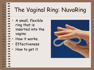 The Vaginal Ring: NuvaRing
• A small, flexible
  ring that is
  inserted into the
  vagina
• How it works.
• Effectiveness
• How to get it
 