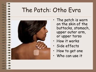 The Patch: Otho Evra
          • The patch is worn
            on the skin of the
            buttocks, stomach,
            upper outer arm,
            or upper torso
          • How it works
          • Side effects
          • How to get one
          • Who can use it
 