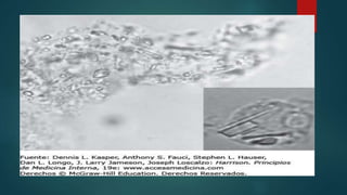 Condrocalcinosis | PPTX