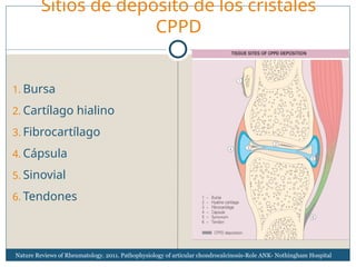 Condrocalcinosis DIAGNOSTICO Y TRATAMIENTO | PPT