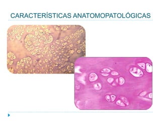 CARACTERÍSTICAS ANATOMOPATOLÓGICAS