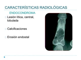 CARACTERÍSTICAS RADIOLÓGICAS
ENDOCONDROMA
Lesión lítica, central,
lobulada
Calcificaciones
Erosión endostal