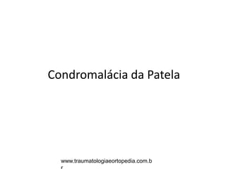 Condromalácia da Patela
www.traumatologiaeortopedia.com.b
 
