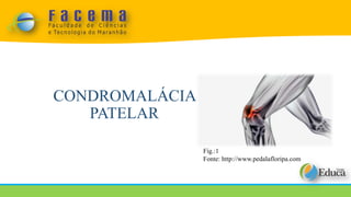 CONDROMALÁCIA
PATELAR
Fig.:1
Fonte: http://www.pedalafloripa.com
 
