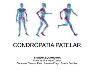 CONDROPATIA PATELAR
SISTEMA LOCOMOTOR
Docente: Francisco Xavier.
Discentes: Tamires Pires, Rosaura Fraga, Samira Böttcher.
 