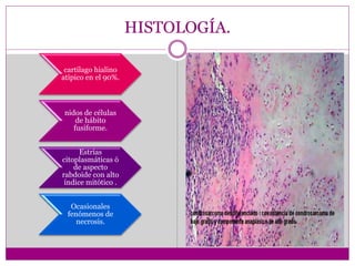 HISTOLOGÍA.
cartílago hialino
atípico en el 90%.
nidos de células
de hábito
fusiforme.
Estrías
citoplasmáticas ó
de aspecto
rabdoide con alto
índice mitótico .
Ocasionales
fenómenos de
necrosis.
 