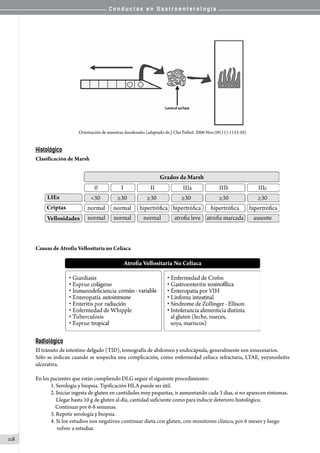 C o n d u c t a s e n G a s t r o e n t e r o l o g í a
118
Orientación de muestras duodenales (adaptado de J Clin Pathol. 2006 Nov;59(11):1133-50)
Histológico
Clasificación de Marsh
Causas de Atrofia Vellositaria no Celiaca
Radiológico
El tránsito de intestino delgado (TID), tomografía de abdomen y endocápsula, generalmente son innecesarios.
Sólo se indican cuando se sospecha una complicación, como enfermedad celíaca refractaria, LTAE, yeyunoileítis
ulcerativa.
En los pacientes que están cumpliendo DLG seguir el siguiente procedimiento:
1. Serología y biopsia. Tipificación HLA puede ser útil.
2. Iniciar ingesta de gluten en cantidades muy pequeñas, ir aumentando cada 3 días, si no aparecen síntomas.
    Llegar hasta 10 g de gluten al día, cantidad suficiente como para inducir deterioro histológico.
    Continuar por 6-8 semanas.
3. Repetir serología y biopsia.
4. Si los estudios son negativos continuar dieta con gluten, con monitoreo clínico, por 6 meses y luego
     volver a estudiar.
 
