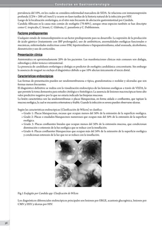 C o n d u c t a s e n G a s t r o e n t e r o l o g í a
36
prevalencia del 10%, en los cuales se considera enfermedad marcadora de SIDA. Se relaciona con inmunosupresión
profunda (CD4 < 200 cel/mm3) y ocurre en fases tardías de la historia natural de la infección por HIV.
Luego de la localización orofaríngea, es el sitio más frecuente de afectación gastrointestinal por Cándida.
Candida Albicans es la causa más común de esofagitis (70-80%), aunque otras especies también se han descripto
como C. tropicalis, C. krusei, C. Glabrata, C. parasilosis y C. Dubliniensis.
Factores predisponentes
Cualquier estado de inmunodepresión es un factor predisponente para su desarrollo. La supresión de la producción
de ácido gástrico (tratamiento con IBP prolongado), uso de antibióticos, anormalidades esofágicas funcionales o
mecánicas, enfermedades endócrinas como DM, hipotiroidismo e hipoparatiroidismo, edad avanzada, alcoholismo,
desnutrición y uso de corticoides.
Presentación clínica
Asintomática en aproximadamente 20% de los pacientes. Las manifestaciones clínicas más comunes son disfagia,
odinofagia y dolor torácico retroesternal.
La presencia de candidiasis orofaríngea y disfagia es predictor de esofagitis candidiásica concomitante. Sin embargo
la ausencia de muguet no excluye el diagnóstico debido a que 10% afectan únicamente el tercio distal.
Características endoscópicas
Las formas de presentación pueden ser seudomembranosa o típica, granulomatosa o nodular y ulceradas que son
formas menos frecuentes.
El diagnóstico definitivo se realiza con la visualización endoscópica de las lesiones esofágicas a través de VEDA, lo
que permite la toma demuestra para estudio citológico e histológico. La ausencia de lesiones macroscópicas tiene alto
valor predictivo negativo por lo que no estaría indicado las biopsias mucosas.
La lesión característica son las seudomembranas o placas blanquecinas, en forma aislada o confluentes, que tapizan la
mucosaesofágica,lacualseencuentraeritematosay friable.Cuando la infección es severapueden observarseulceras.
Según las características endoscópicas (Clasificación de Wilcox) se clasifica:
• Grado 1: Placas blanquecinas, escasas que ocupan menos del 50% de la extensión de la superficie esofágica.
• Grado 2: Placas o exudados blanquecinos numerosos que ocupan más del 50% de la extensión de la superficie
esofágica.
• Grado 3: Placas conﬂuentes lineales que ocupan menos del 50% de la extensión mucosa, que condicionan
disminución o estenosis de la luz esofágica que se reduce con la insuflación.
• Grado 4: Placas confluentes blanquecinas que ocupan más del 50% de la extensión de la superficie esofágica
y condicionan estenosis de la luz que no se reduce con la insuflación.
Fig.1 Esofagitis por Candida spp: Clasificación de Wilcox
Los diagnósticos diferenciales endoscópicos principales son lesiones por ERGE, acantosis glucogénica, lesiones por
CMV y HSV y úlceras por HIV.
 