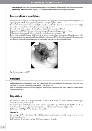 C o n d u c t a s e n G a s t r o e n t e r o l o g í a
38
• Localización: Afectaprincipalmente elesófago medio y distal, aunque también estádescripto el compromiso difuso
• Complicaciones: hemorragia digestiva (5%) y raramente estenosis o fístulas traqueobronquiales   
Características endoscópicas
La apariencia endoscópica es variable. Se pueden observar desde pequeñas erosiones superficiales serpinginosas y de
aspecto geográfico hasta úlceras gigantes y profundas o esofagitis superficial difusa.
Pueden encontrarse lesiones únicas o múltiples, aisladas o confluentes. Cuando se presentan en forma múltiple
pueden tener puentes de mucosa sana (puentes mucosos) que las unen.
Los bordes de la lesión son pocos elevados y bien delimitados (en molde de medallón).
En pacientes con SIDA, las úlceras son frecuentemente grandes y profundas y pueden ser > 20mm.
El diagnóstico diferencial endoscópico principal es con las úlceras ideopáticas por HIV.
Deben tomarse múltiples biopsias desde la base de las úlceras, ya que el efecto citopático del CMV está presente en los
fibroblastos de la submucosa y en las células endoteliales (en lesiones por HSV en el epitelio escamoso). No hay consenso
en relación al número de muestras a tomar, se recomiendan muestras con alto rédito diagnóstico.
Fig. 2 Lesión esofágica por CMV
Histología
La biopsia demuestra destrucción tisular y la presencia de cuerpos de inclusión citoplasmáticos o intranucleares
basófilos con una reacción inflamatoria alrededor y halo perinuclear.  
Estas inclusiones se encuentran en células gigantes denominadas citomegálicas, que tienen 2-4 veces el tamaño normal
(signo patognomónico).
Diagnóstico
Se establece a partir de las biopsias tomadas en fondo de la úlcera. Se realiza estudio histopatológico,
inmunohistoquímica, cultivo y PCR.
Los cultivos virales de las biopsias son menos sensibles y específicos que la histología. La identificación de una
inclusión aislada encontrada por inmunohistoquímica no debe considerarse enfermedad por CMV.
La detección de DNA por PCR es el método más sensible.
Laboratorio
La viremia por CMV puede ser detectada por PCR, antigenemia o hemocultivos y puede estar presente en ausencia
de enfermedad invasiva.   
Dado la alta tasa de exposición previa al CMV, la serología no es de ayuda.
 