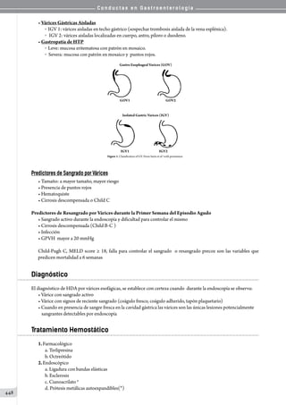 C o n d u c t a s e n G a s t r o e n t e r o l o g í a
448
• Várices Gástricas Aisladas
o   IGV 1: várices aisladas en techo gástrico (sospechar trombosis aislada de la vena esplénica).
o    IGV 2: várices aisladas localizadas en cuerpo, antro, píloro o duodeno.
• Gastropatía de HTP
o   Leve: mucosa eritematosa con patrón en mosaico.
o   Severa: mucosa con patrón en mosaico y  puntos rojos.
Gastro Esophageal Varices (GOV)
Isolated Gastric Varices (IGV)
Figure 1. Classification of GV. From Sarin et al.8 with permission
GOV2
IGV1 IGV2
GOV1
Predictores de Sangrado por Várices
• Tamaño: a mayor tamaño, mayor riesgo
• Presencia de puntos rojos
• Hematoquiste
• Cirrosis descompensada o Child C
Predictores de Resangrado por Várices durante la Primer Semana del Episodio Agudo
• Sangrado activo durante la endoscopía y dificultad para controlar el mismo
• Cirrosis descompensada (Child B-C )
• Infección
• GPVH  mayor a 20 mmHg
Child-Pugh C, MELD score ≥ 18, falla para controlar el sangrado  o resangrado precoz son las variables que
predicen mortalidad a 6 semanas
Diagnóstico
El diagnóstico de HDA por várices esofágicas, se establece con certeza cuando  durante la endoscopía se observa:
• Várice con sangrado activo
• Várice con signos de reciente sangrado (coágulo fresco, coágulo adherido, tapón plaquetario)
• Cuando en presencia de sangre fresca en