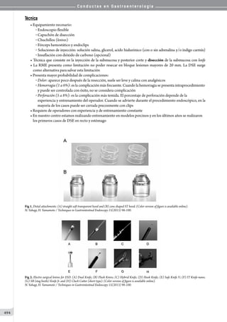 Conductas en gastroenterologia