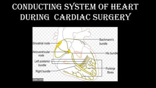conducting system of heart
during cardiac surgery
 