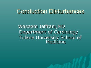 Conduction DisturbancesConduction Disturbances
Waseem Jaffrani,MDWaseem Jaffrani,MD
Department of CardiologyDepartment of Cardiology
Tulane University School ofTulane University School of
MedicineMedicine
 