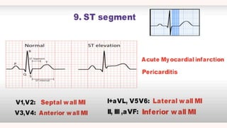 Conduction and its abnormalities .pdf