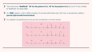 Conduction and its abnormalities .pdf