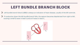 V1 Conduction Block Conduction and its abnormalities .pdf