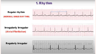 Conduction and its abnormalities .pdf