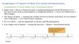 Second-degree (2nd degree) AV block: ECG criteria and characteristics
• Second-degree AV block Mobitz type I (Wenckebach block)
 Mobitz type 1 block is characterized by a gradual prolongation of the PR interval over a
few heart cycles until an atrial impulse is completely blocked → P-wave not followed by a
QRS complex.
 The degree of block → counting the number of P-waves before each block. If every third P-
wave is blocked → 3-to-2 block (most common).
 In 2-to-1 block → may be impossible to observe and PR prolongation.
 Very simple rule of thumb → varying PR intervals → Mobitz 1 (Wenckebach block)
 