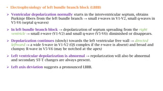 • Electrophysiology of left bundle branch block (LBBB)
 Ventricular depolarization normally starts in the interventricular septum, obtains
Purkinje fibers from the left bundle branch → small r-waves in V1-V2, small q-waves in
V5-V6 (septal q-waves)
 In left bundle branch block → depolarization of septum spreading from the right
ventricle → small r-wave (V1-V2) and small q-wave (V5-V6): diminished or disappears.
 Depolarization continues (slowly) towards the left ventricular free wall → directed
leftward → a wide S-wave in V1-V2 (QS complex if the r-wave is absent) and broad and
clumpsy R-wave in V5-V6 (may be notched at the apex)
 Left ventricular depolarization is abnormal → repolarization will also be abnormal
and secondary ST-T changes are always present.
 Left axis deviation suggests a pronounced LBBB.
 