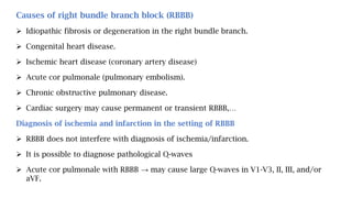 Causes of right bundle branch block (RBBB)
 Idiopathic fibrosis or degeneration in the right bundle branch.
 Congenital heart disease.
 Ischemic heart disease (coronary artery disease)
 Acute cor pulmonale (pulmonary embolism).
 Chronic obstructive pulmonary disease.
 Cardiac surgery may cause permanent or transient RBBB,…
Diagnosis of ischemia and infarction in the setting of RBBB
 RBBB does not interfere with diagnosis of ischemia/infarction.
 It is possible to diagnose pathological Q-waves
 Acute cor pulmonale with RBBB → may cause large Q-waves in V1-V3, II, III, and/or
aVF.
 