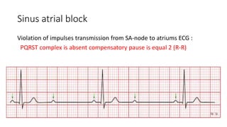 Conduction disorders.pptx