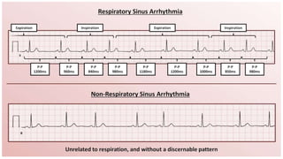 Conduction disorders.pptx