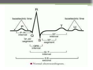 Conduction system and ecg