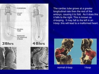The cardiac tube grows at a greater
longitudinal rate then the rest of the
embryo, causing it to fold. As it does this
it falls to the right. This is known as
d-looping. It may fall to the left in an
l-loop: this will lead to a malformed heart.
.

normal d-loop

l-loop

 