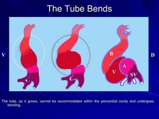 The Tube Bends

V

B

D
A

V

SV

The tube, as it grows, cannot be accommodated within the pericardial cavity and undergoes
bending.

 