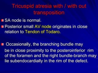 Tricuspid atresia with / with out
transposition
SA node is normal.
Posterior small AV node originates in close
relation to Tendon of Todaro.

Occasionally, the branching bundle may
be in close proximity to the posteroinferior rim
of the foramen and the right bundle-branch may
lie subendocardially in the rim of the defect.

 