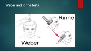 Weber and Rinne tests
 