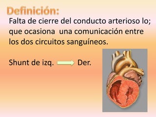 Falta de cierre del conducto arterioso lo;
que ocasiona una comunicación entre
los dos circuitos sanguíneos.
Shunt de izq. Der.