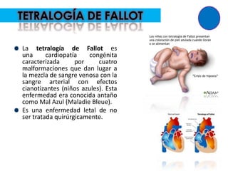 TETRALOGÍA DE FALLOT

La tetralogía de Fallot es
una      cardiopatía   congénita
caracterizada      por     cuatro
malformaciones que dan lugar a
la mezcla de sangre venosa con la
sangre arterial con efectos
cianotizantes (niños azules). Esta
enfermedad era conocida antaño
como Mal Azul (Maladie Bleue).
Es una enfermedad letal de no
ser tratada quirúrgicamente.
 