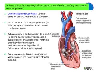 La forma clásica de la tetralogía abarca cuatro anomalías del corazón y sus mayores
 vasos sanguíneos:

1) Comunicación interventricular (orificio
   entre los ventrículos derecho e izquierdo).

2) Estrechamiento de la arteria pulmonar (la
   válvula y arteria que conectan el corazón
   con los pulmones).

3) Cabalgamiento o dextraposición de la aorta
   (la arteria que lleva sangre oxigenada al
   cuerpo) que se traslada sobre el ventrículo
   derecho y la comunicación
   interventricular, en lugar de salir
   únicamente del ventrículo izquierdo.

4) Engrosamiento de la pared muscular del
   ventrículo derecho (hipertrofia ventricular
   derecha).
 