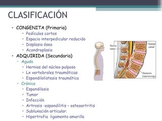 CLASIFICACIÓN
• CONGENITA (Primaria)
• Pedículos cortos
• Espacio interpedicular reducido
• Displasia ósea
• Acondroplasia
• ADQUIRIDA (Secundaria)
▫ Aguda
• Hernias del núcleo pulposo
• Lx vertebrales traumáticas
• Espondilolistesis traumática
• Crónica
• Espondilosis
• Tumor
• Infección
• Artrosis -espondilitis – osteoartritis
• Subluxación articular.
• Hipertrofia ligamento amarillo
 