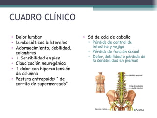 CUADRO CLÍNICO
• Dolor lumbar
• Lumbociáticas bilaterales
• Adormecimiento, debilidad,
calambres
• ↓ Sensibilidad en pies
• Claudicación neurogénica
• ↑ dolor con hiperextensión
de columna
• Postura antropoide: “ de
carrito de supermercado”
• Sd de cola de caballo:
▫ Pérdida de control de
intestino y vejiga
▫ Pérdida de función sexual
▫ Dolor, debilidad o pérdida de
la sensibilidad en piernas
 