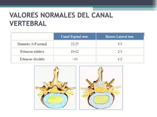 VALORES NORMALES DEL CANAL
VERTEBRAL
 